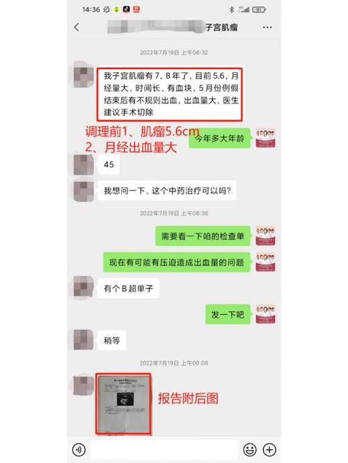有“消字号”皮肤产品以中药为噱头进入市场 皮肤科专家不会建议患者运用任何“消字号”产品治疗 人工智能 有“消字号”皮肤产品以中药为噱头进入市场 皮肤科专家不会建议患者运用任何“消字号”产品治疗 有“消字号”皮肤产品以中药为噱头进入市场 皮肤科专家不会建议患者运用任何“消字号”产品治疗 人工智能