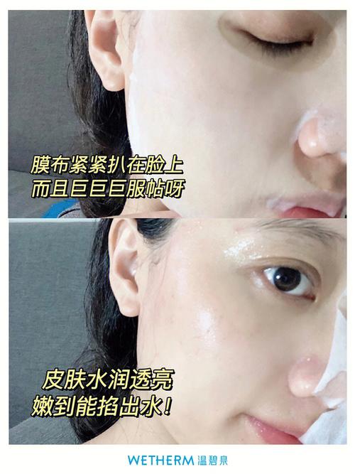 松霖科技取得小我皮肤护理装配专利实现扫描面积的扩大和较好的散热效果 互联通信 松霖科技取得小我皮肤护理装配专利实现扫描面积的扩大和较好的散热效果 松霖科技取得小我皮肤护理装配专利实现扫描面积的扩大和较好的散热效果 互联通信