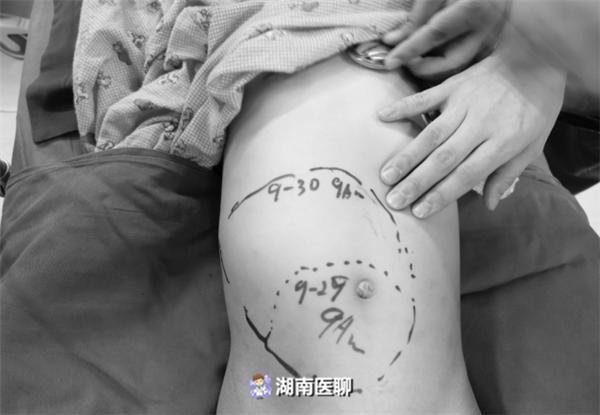 海妙华美天资被吊销还给人做整形 女孩术后出现“硬块” 人工智能 海妙华美天资被吊销还给人做整形 女孩术后出现“硬块” 海妙华美天资被吊销还给人做整形 女孩术后出现“硬块” 人工智能
