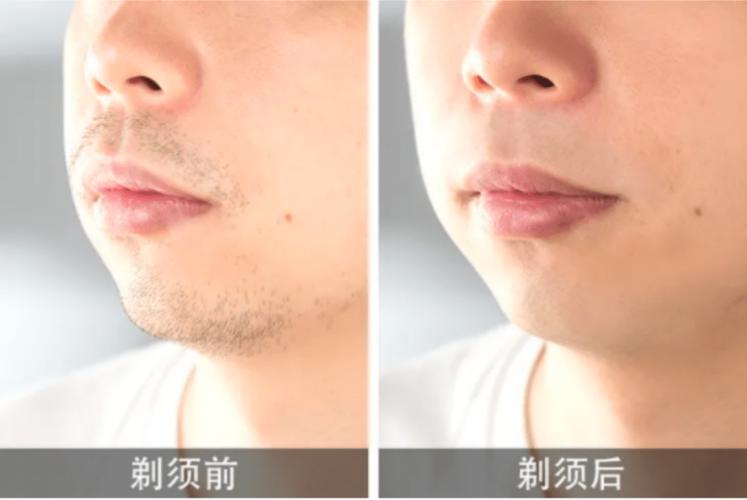 华为生态又出黑发明「剃须刀」!AI加速不扯须顺滑如丝 智能家居 华为生态又出黑发明「剃须刀」!AI加速不扯须顺滑如丝 华为生态又出黑发明「剃须刀」!AI加速不扯须顺滑如丝 智能家居