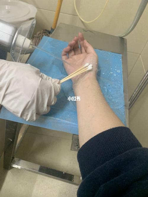 夜里被金毛挠破手去病院打狂犬疫苗记第一次用电子医保卡的我 智能科技 夜里被金毛挠破手去病院打狂犬疫苗记第一次用电子医保卡的我 夜里被金毛挠破手去病院打狂犬疫苗记第一次用电子医保卡的我 智能科技