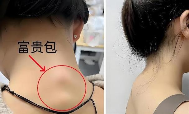 “富贵包”怎么“破”? 人工智能 “富贵包”怎么“破”? “富贵包”怎么“破”? 人工智能