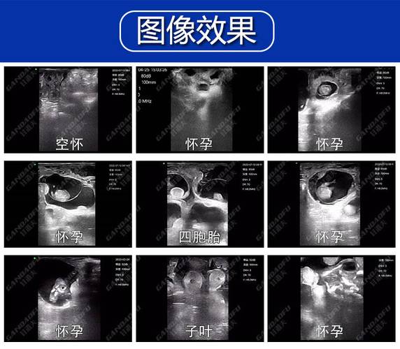 无线羊用B超价格兽用无线B超品牌厂家报价趋势 智能科技 无线羊用B超价格兽用无线B超品牌厂家报价趋势 无线羊用B超价格兽用无线B超品牌厂家报价趋势 智能科技