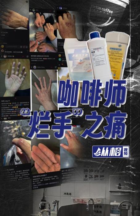 瑞幸员工手如焦土 清洗流程致人手烂 如拍片子特效 智能家居 瑞幸员工手如焦土 清洗流程致人手烂 如拍片子特效 瑞幸员工手如焦土 清洗流程致人手烂 如拍片子特效 智能家居