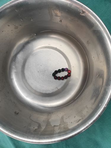 青春做事热线|又是磁力珠惹的祸?年夜夫:暑期别让异物吞食伤害了孩子 人工智能 青春做事热线|又是磁力珠惹的祸?年夜夫:暑期别让异物吞食伤害了孩子 青春做事热线|又是磁力珠惹的祸?年夜夫:暑期别让异物吞食伤害了孩子 人工智能