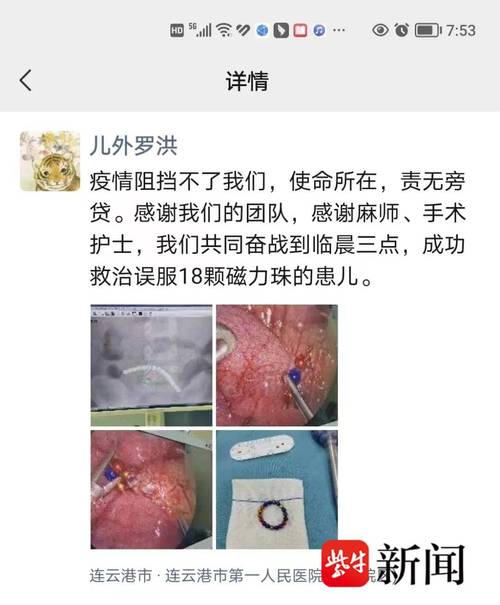 1岁女宝误吞磁力珠肠穿孔同济专家呼吁:儿童应严格禁止接触磁力珠 智能家居 1岁女宝误吞磁力珠肠穿孔同济专家呼吁:儿童应严格禁止接触磁力珠 1岁女宝误吞磁力珠肠穿孔同济专家呼吁:儿童应严格禁止接触磁力珠 智能家居