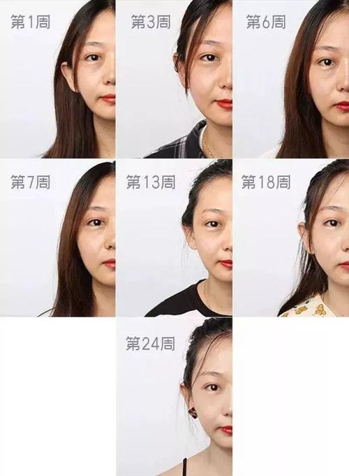 连续熬夜五天 年轻须眉突发脑梗 人工智能 连续熬夜五天 年轻须眉突发脑梗 连续熬夜五天 年轻须眉突发脑梗 人工智能