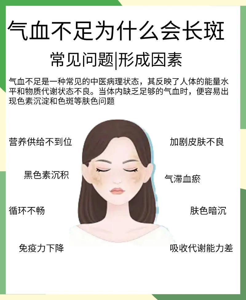 天天面对电脑易长斑都是辐射惹的祸？年夜夫教你若何淡化斑点 天天面对电脑易长斑都是辐射惹的祸？年夜夫教你若何淡化斑点 智能家居