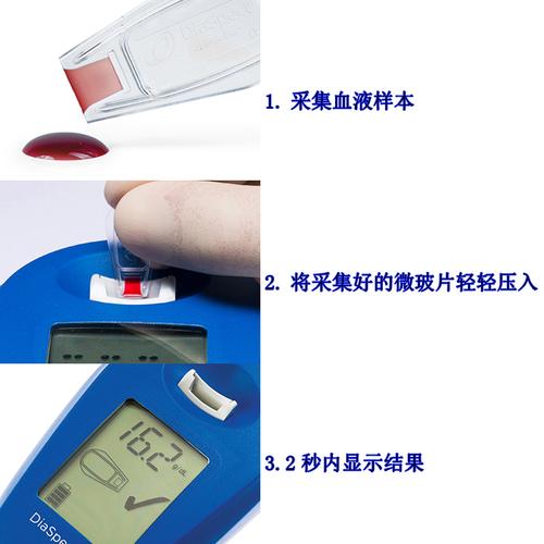 德国EKF DiaSpect Tm进口便携式手持血红蛋白分析仪 互联通信 德国EKF DiaSpect Tm进口便携式手持血红蛋白分析仪 德国EKF DiaSpect Tm进口便携式手持血红蛋白分析仪 互联通信