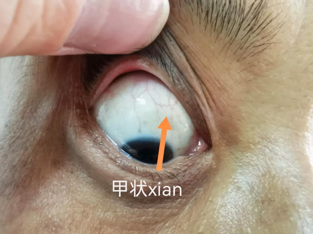 看手机时间长眼睛酸痛有红血丝有什么解决的办法 智能科技 看手机时间长眼睛酸痛有红血丝有什么解决的办法 看手机时间长眼睛酸痛有红血丝有什么解决的办法 智能科技