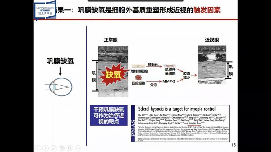 年纪大年夜了视觉减退？科学家解析灵长类视网膜衰老的分子机制 年纪大年夜了视觉减退？科学家解析灵长类视网膜衰老的分子机制 智能科技
