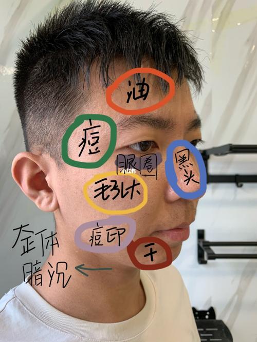 手机耍多了不一定长痘、长胖、独身单身……但可能让你遭这个病! 互联通信 手机耍多了不一定长痘、长胖、独身单身……但可能让你遭这个病! 手机耍多了不一定长痘、长胖、独身单身……但可能让你遭这个病! 互联通信