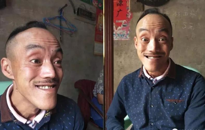 “丑人”俱乐部和“残疾”史 “丑人”俱乐部和“残疾”史 智能科技